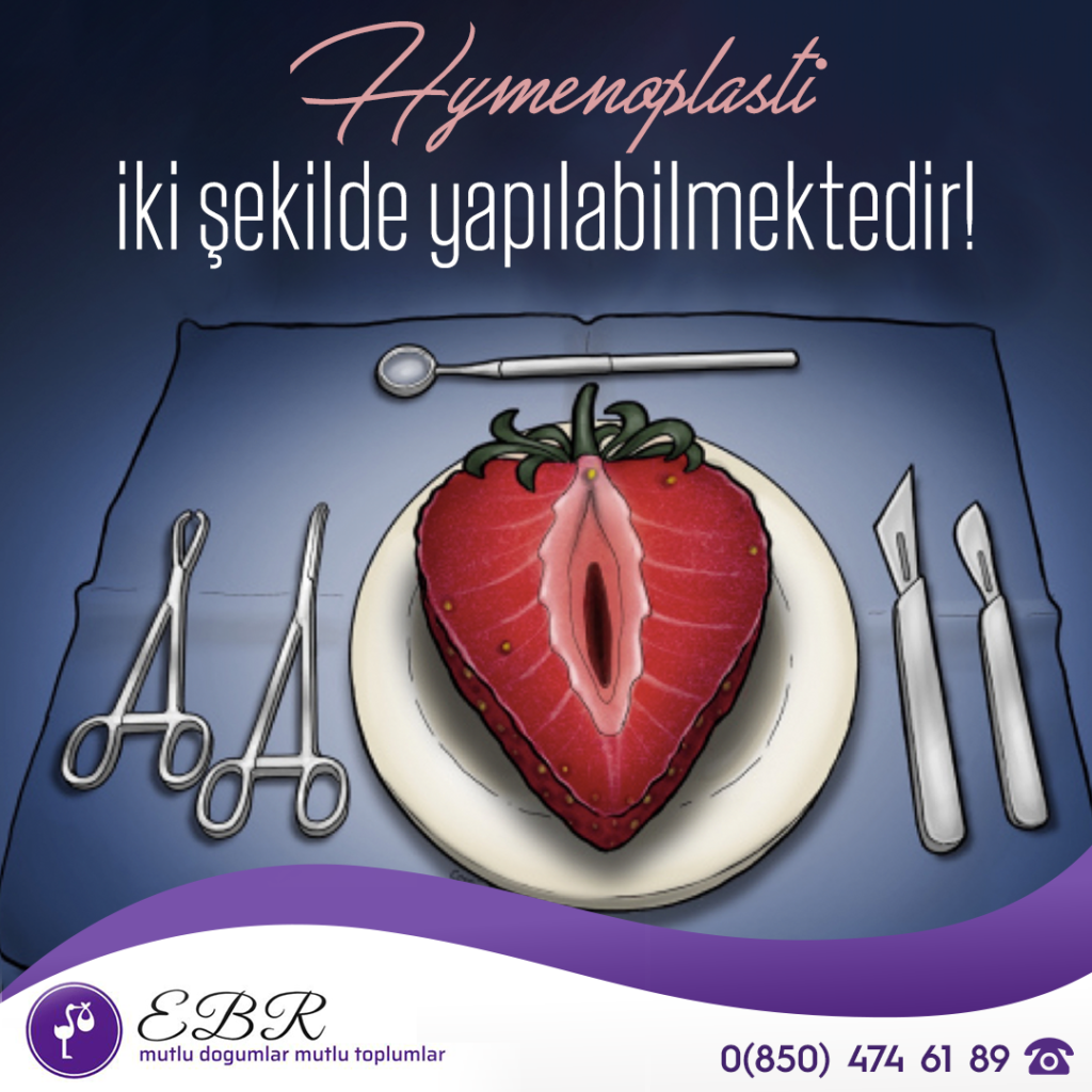 Hymenoplasti İki Şekilde Yapılabilmektedir!