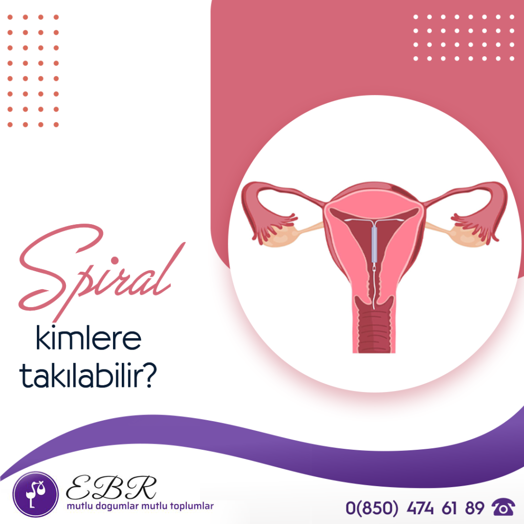 Spiral kimlere takılabilir?