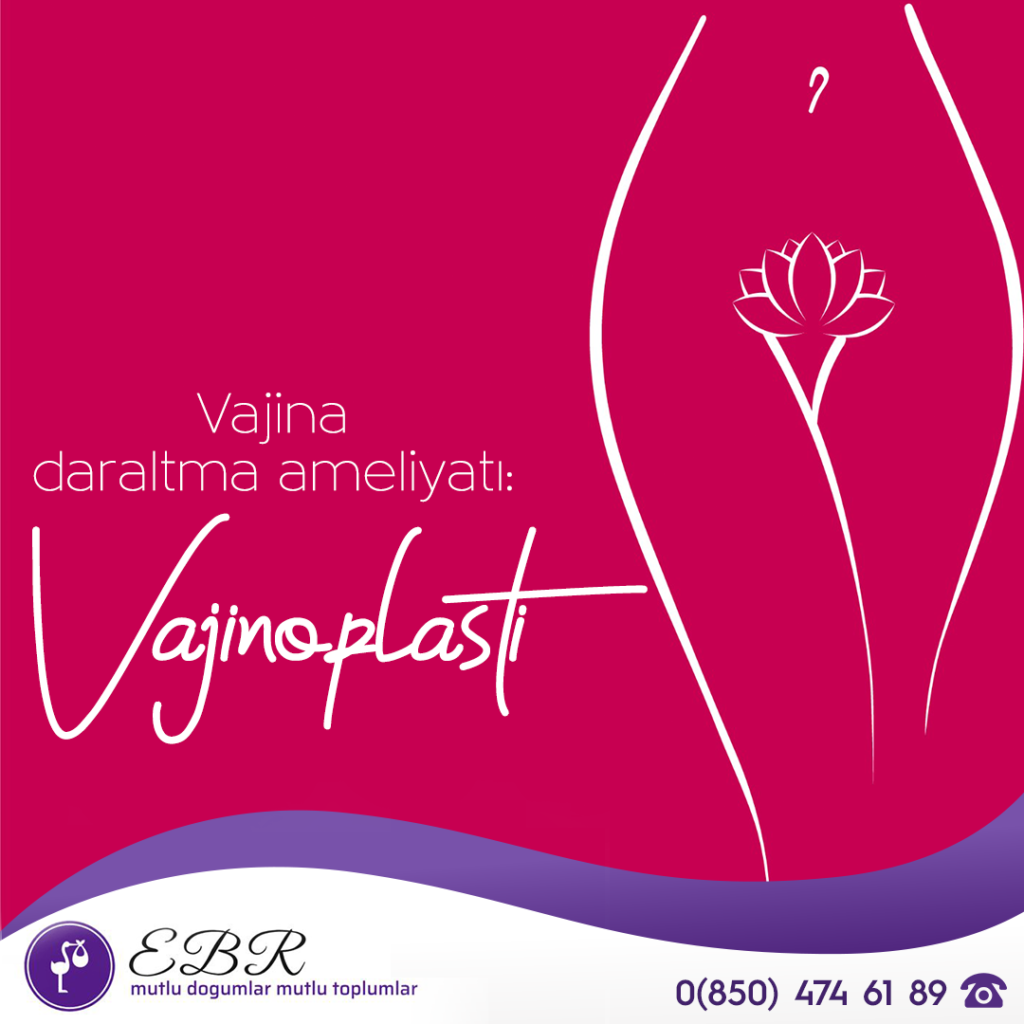 Vajina daraltma ameliyatı Vajinoplasti
