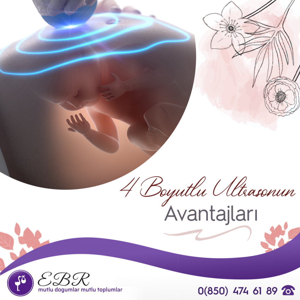 4 boyutlu ultrasonun avantajları