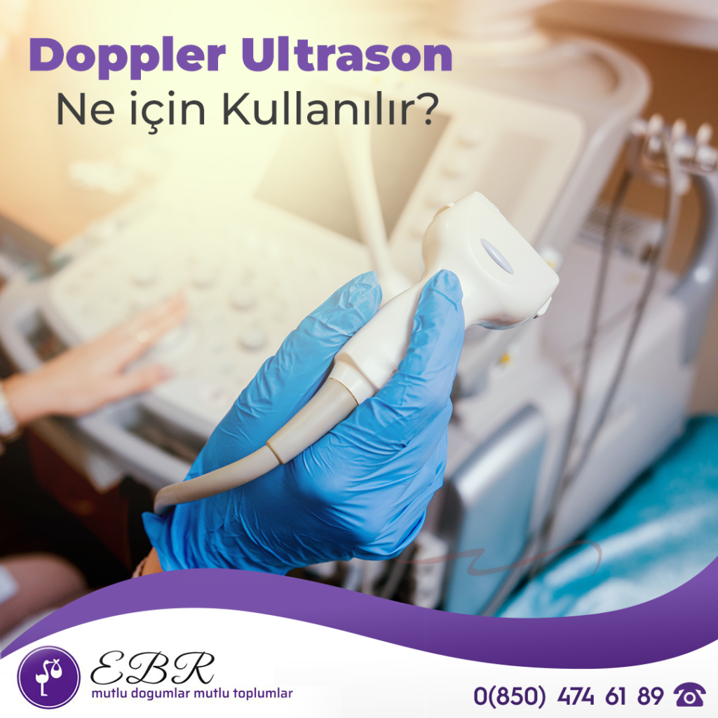 Doppler Ultrason Ne için Kullanılır