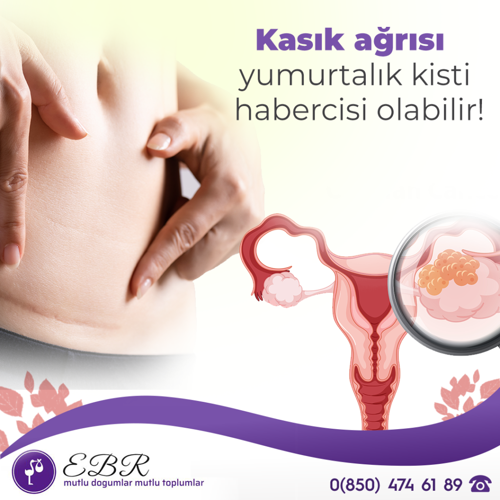 Kasık ağrısı ve adet düzensizliği yumurtalık kisti belirtisi olabilir